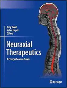 Neuraxial Therapeutics: A Comprehensive Guide
