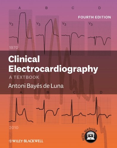 Clinical Electrocardiography: A Textbook, 4th Edition