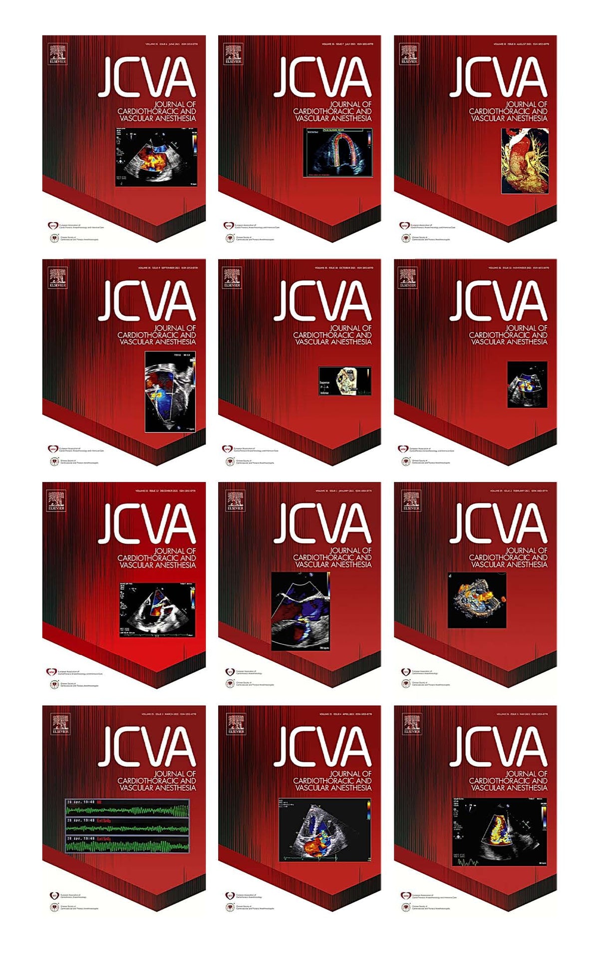 Journal of Cardiothoracic and Vascular Anesthesia 2021 Full Archives