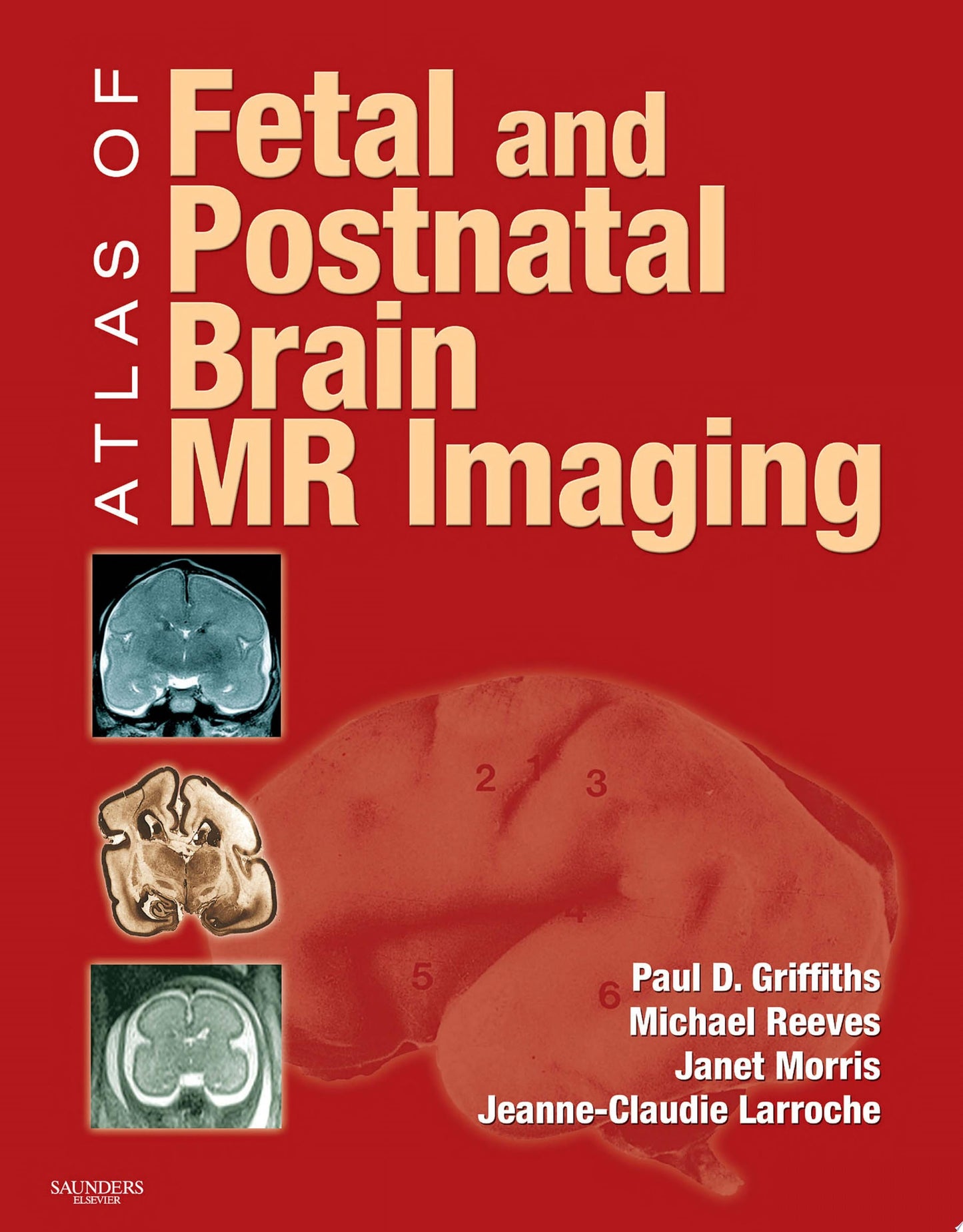 Atlas of Fetal and Postnatal Brain MR Imaging