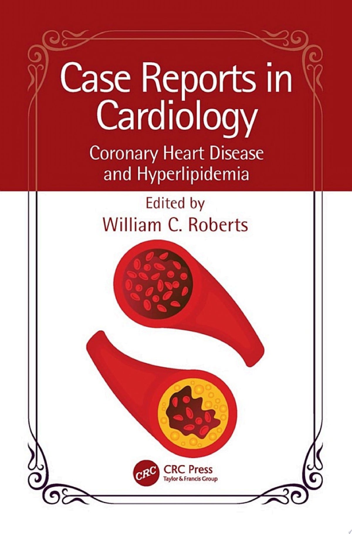 Case Reports in Cardiology: Valvular Heart Disease