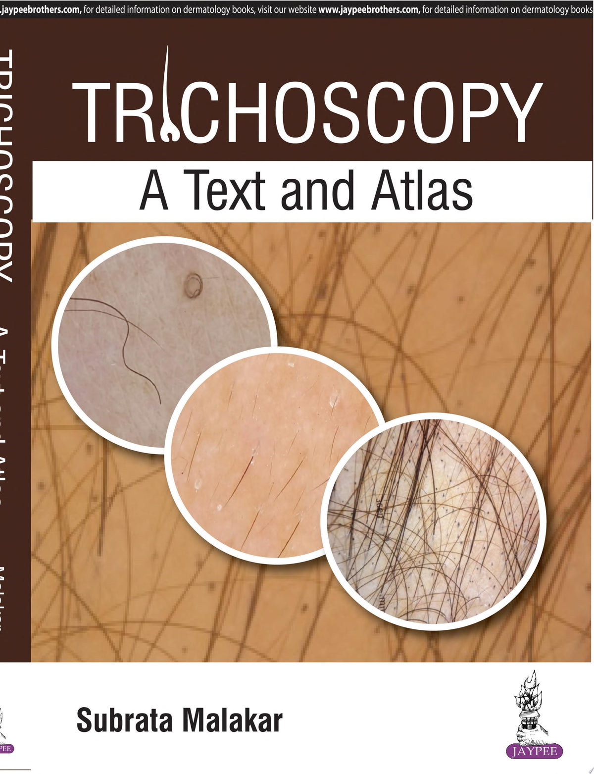 Trichoscopy: A Text and Atlas