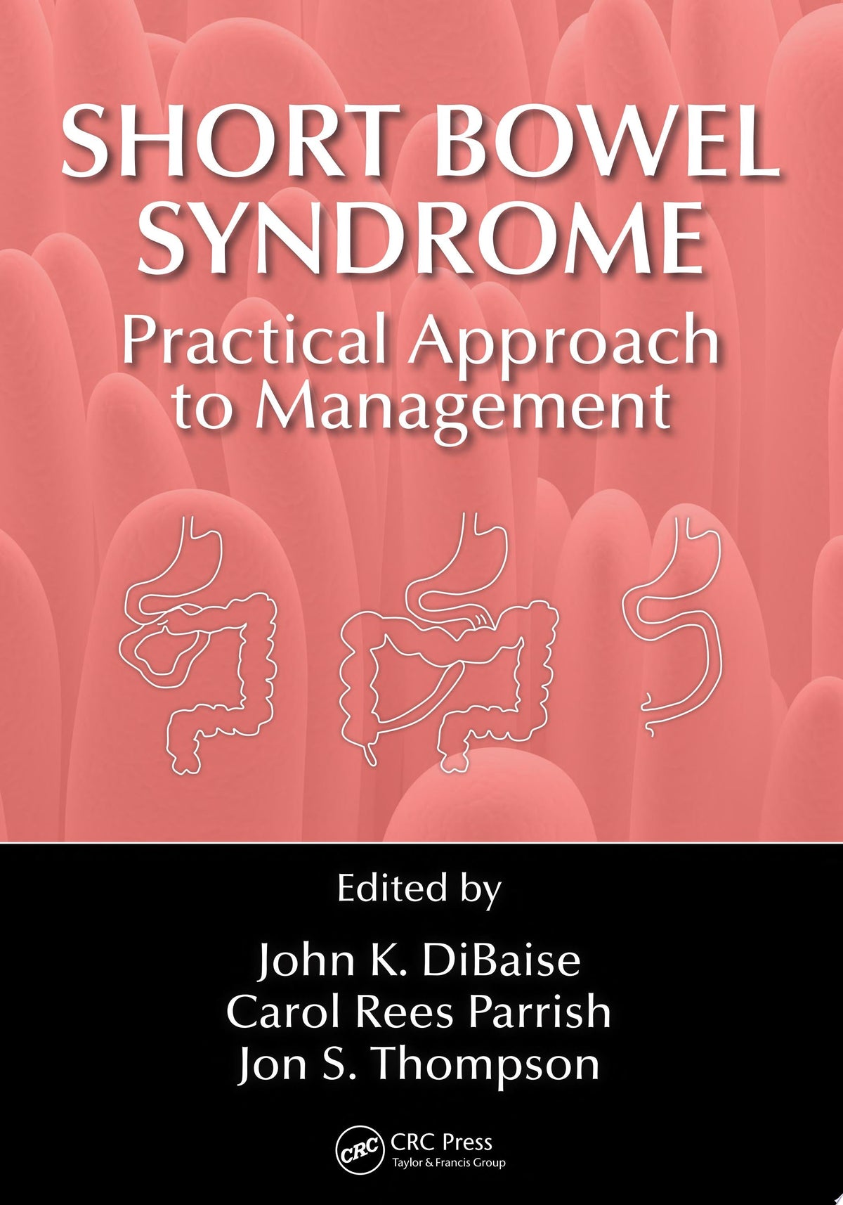 Short Bowel Syndrome: Practical Approach to Management