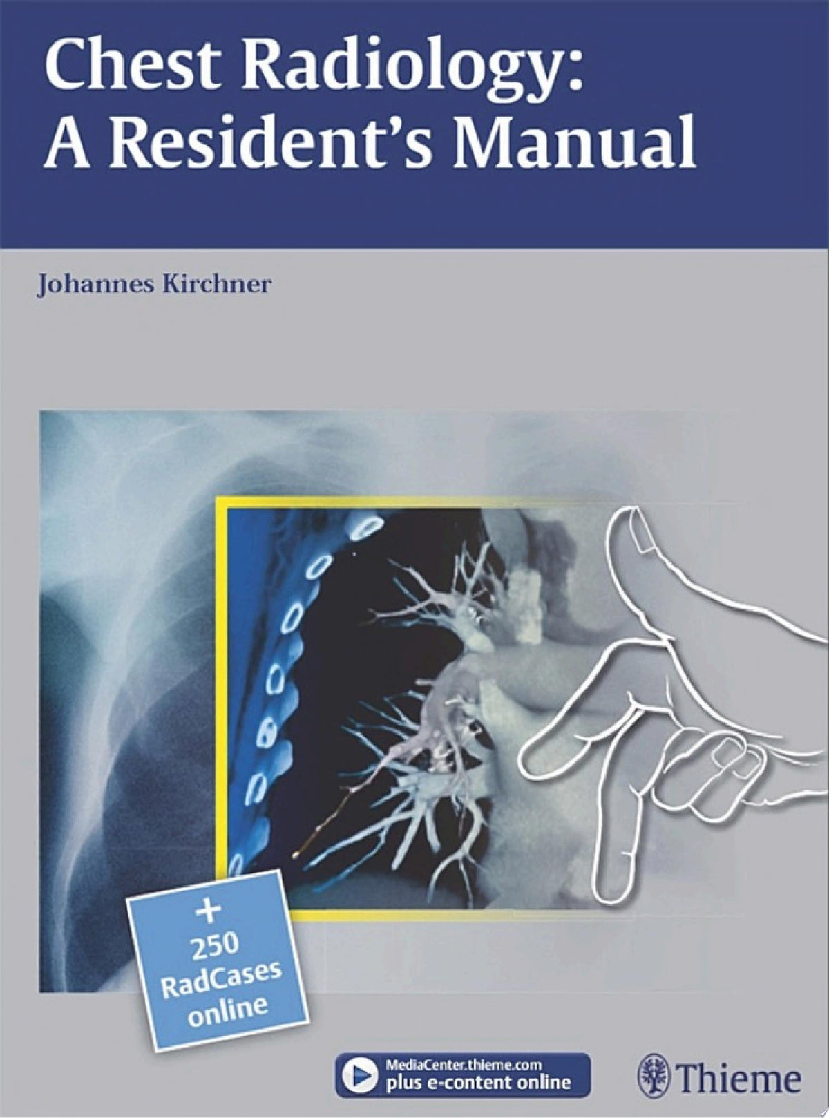 Chest Radiology– A Resident’s Manual