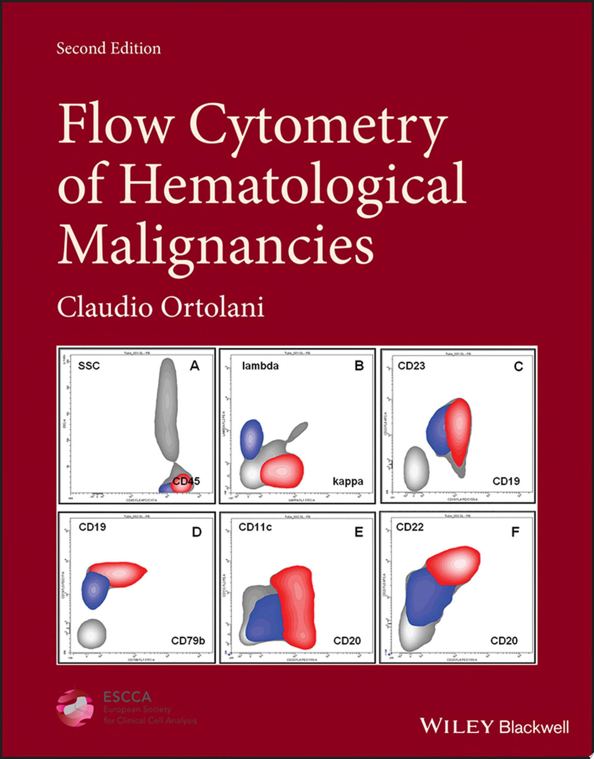 Flow Cytometry of Hematological Malignancies, 2nd edition