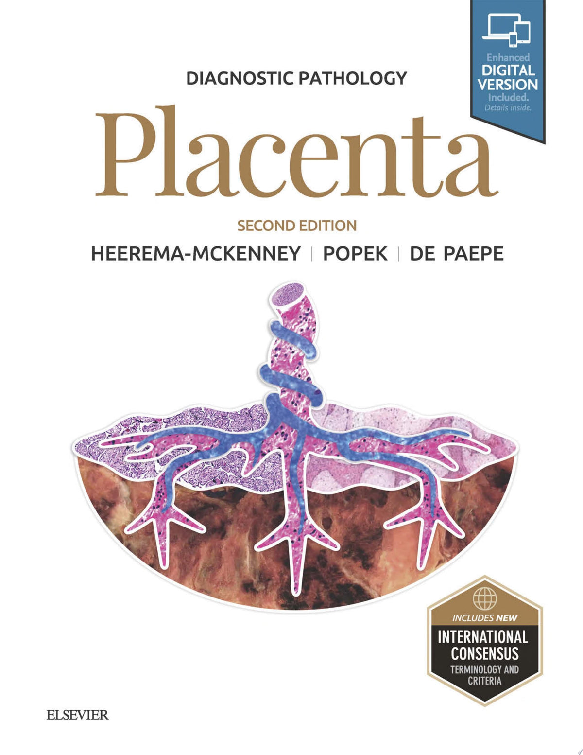 Diagnostic Pathology: Placenta, 2nd Edition