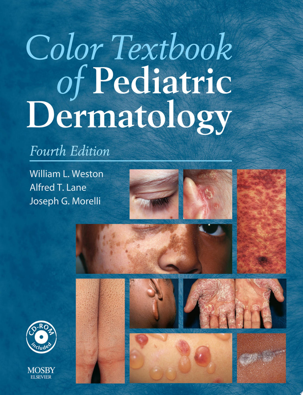 Color Textbook of Pediatric Dermatology, 4th Edition