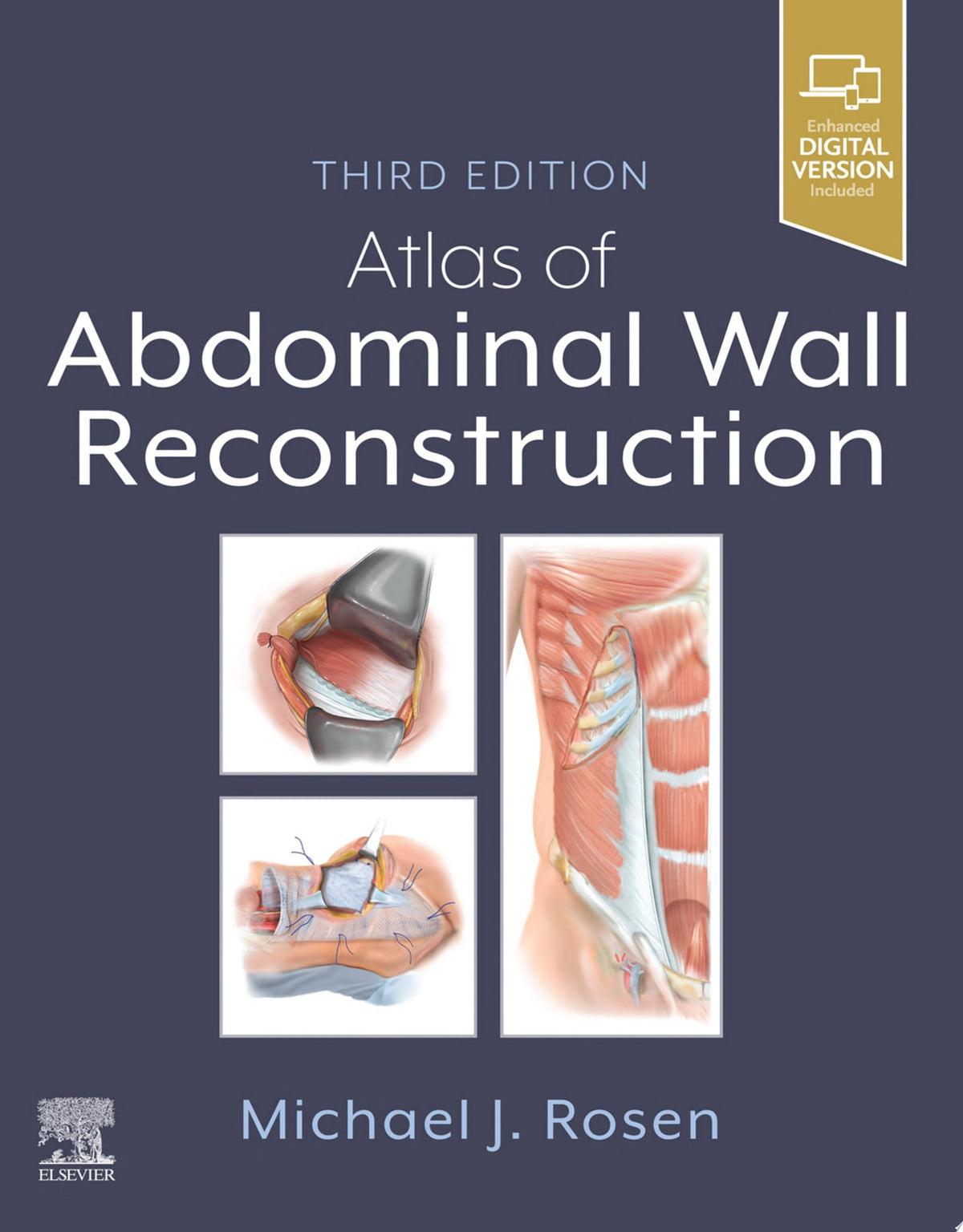Atlas of Abdominal Wall Reconstruction, 3rd Edition