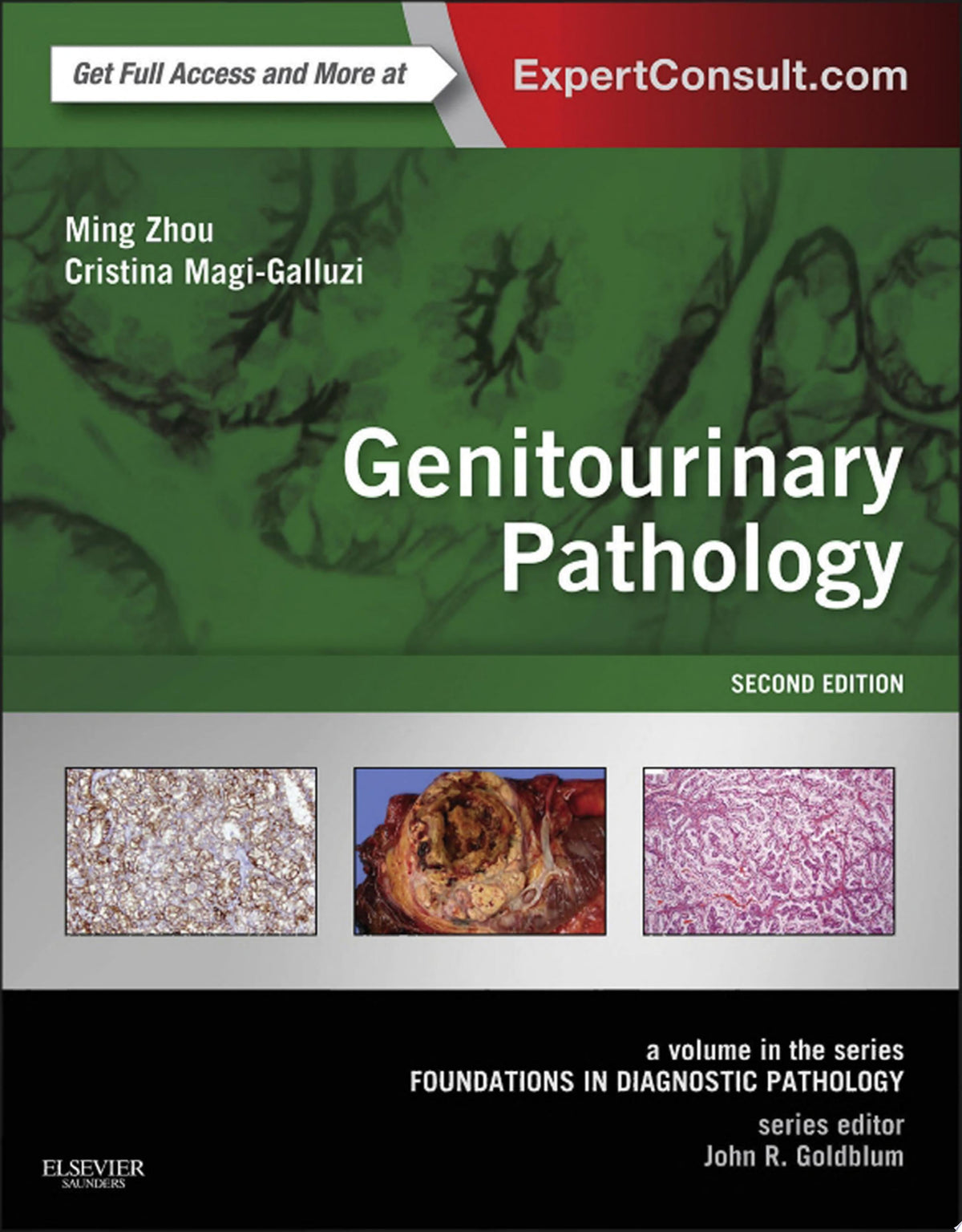Genitourinary Pathology: A Volume in the Series: Foundations in Diagnostic Pathology, 2nd Edition