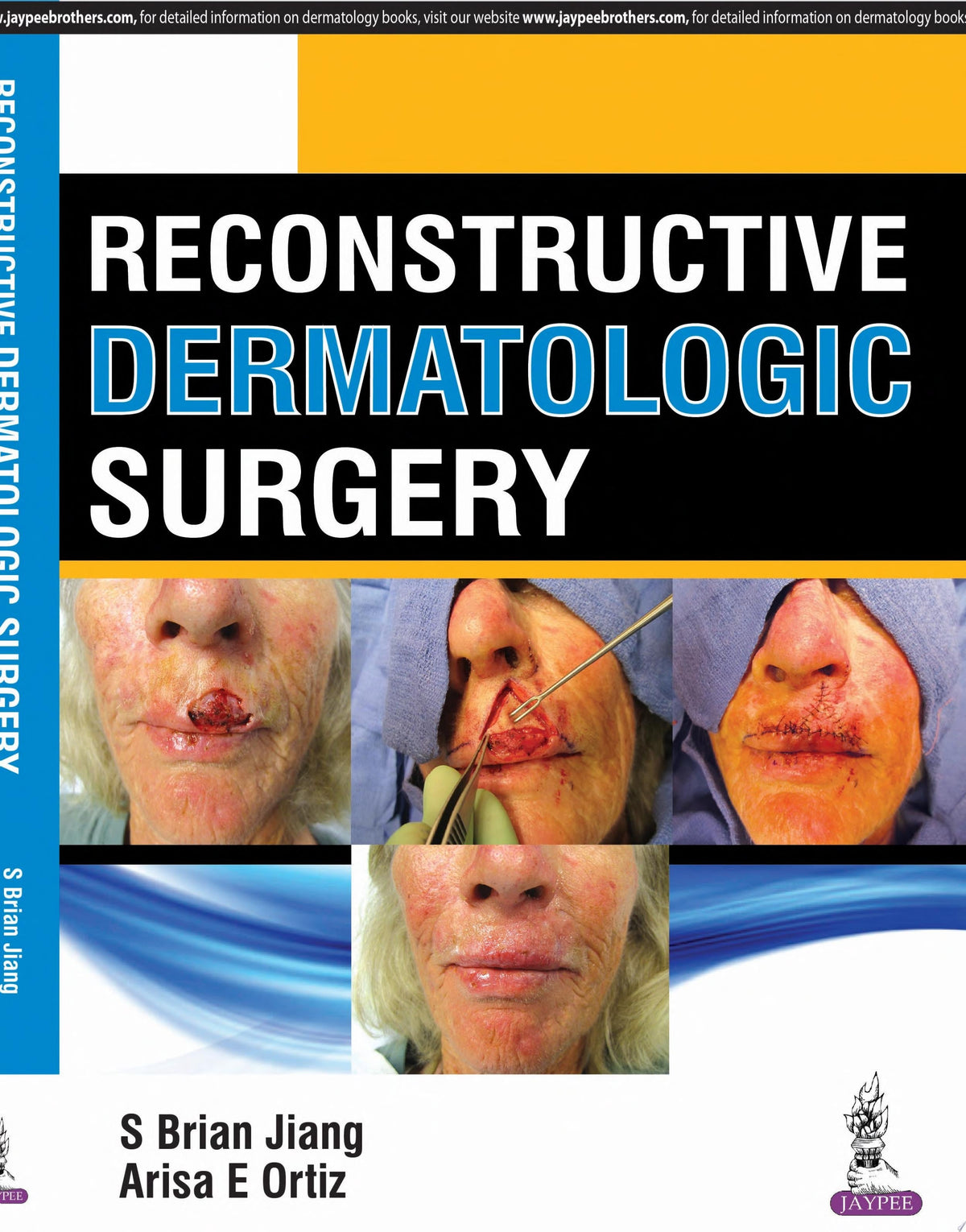 Reconstructive Dermatologic Surgery