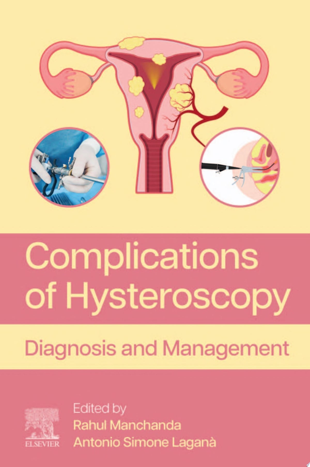 Complications of Hysteroscopy: Diagnosis and Management
