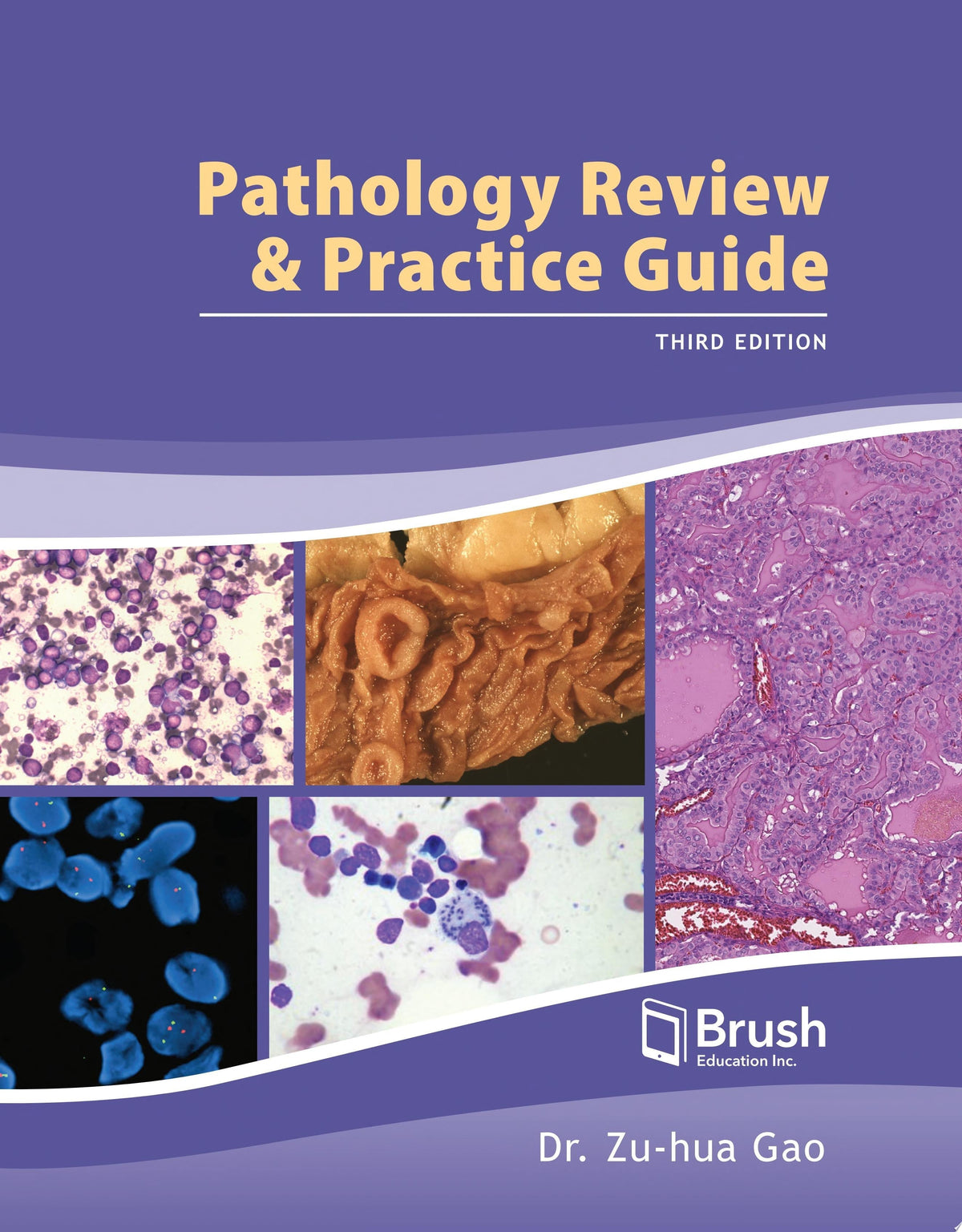 AJCC Cancer Staging System: Cervix Uteri Protocol for Cancer Staging Documentation