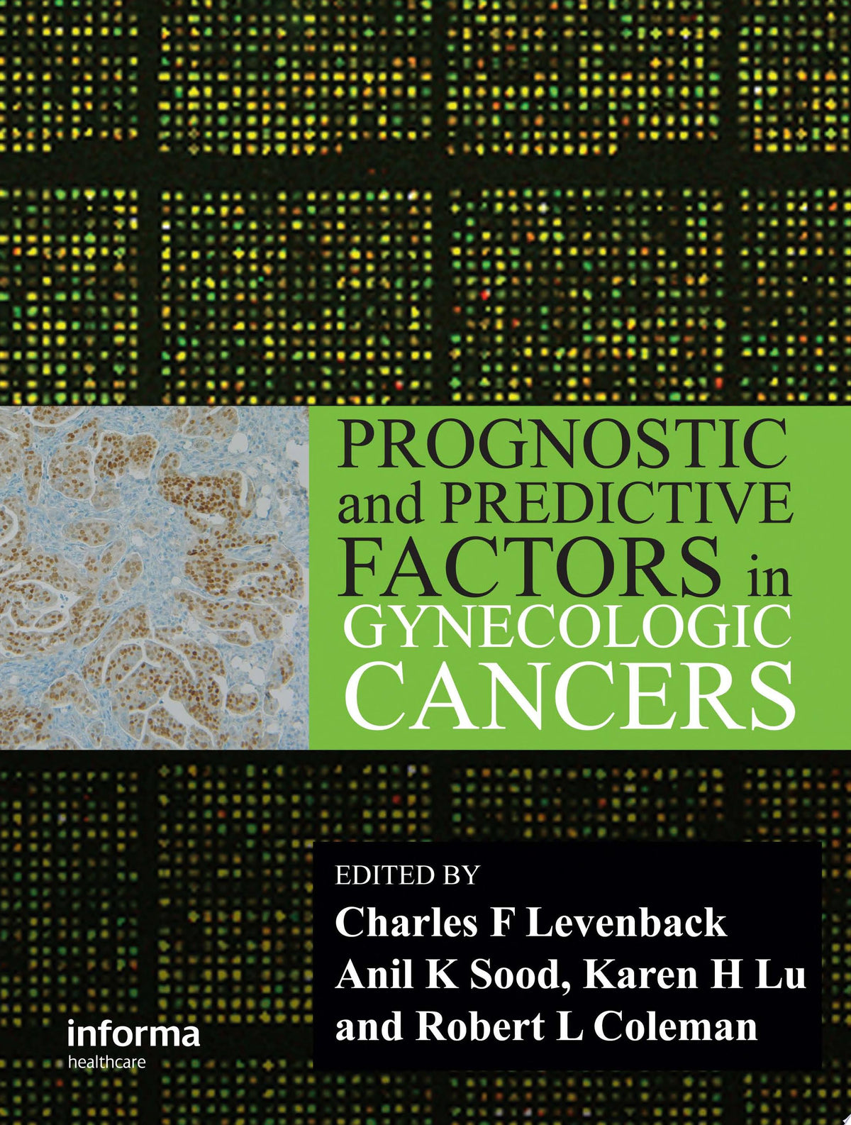 Clinical Lymphatic Mapping in Gynecologic Cancers, 2nd Edition