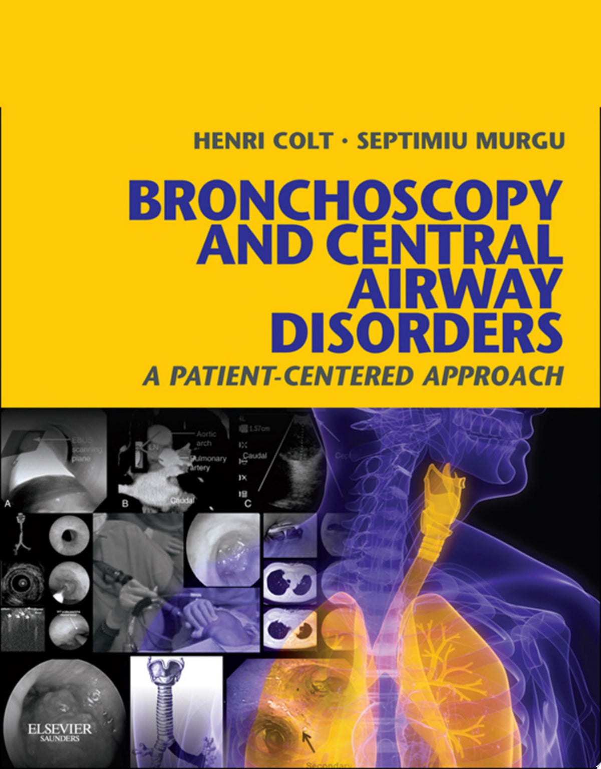 Bronchoscopy and Central Airway Disorders: A Patient-Centered Approach: Expert Consult Online and Print