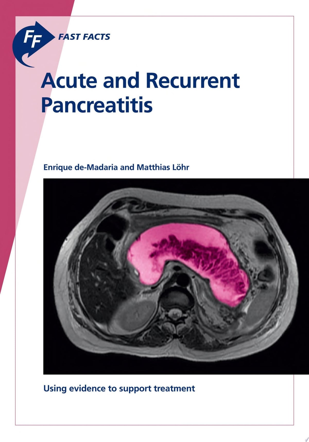 Fast Facts: Acute and Recurrent Pancreatitis: Using evidence to support treatment