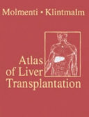 Atlas of Liver Transplantation