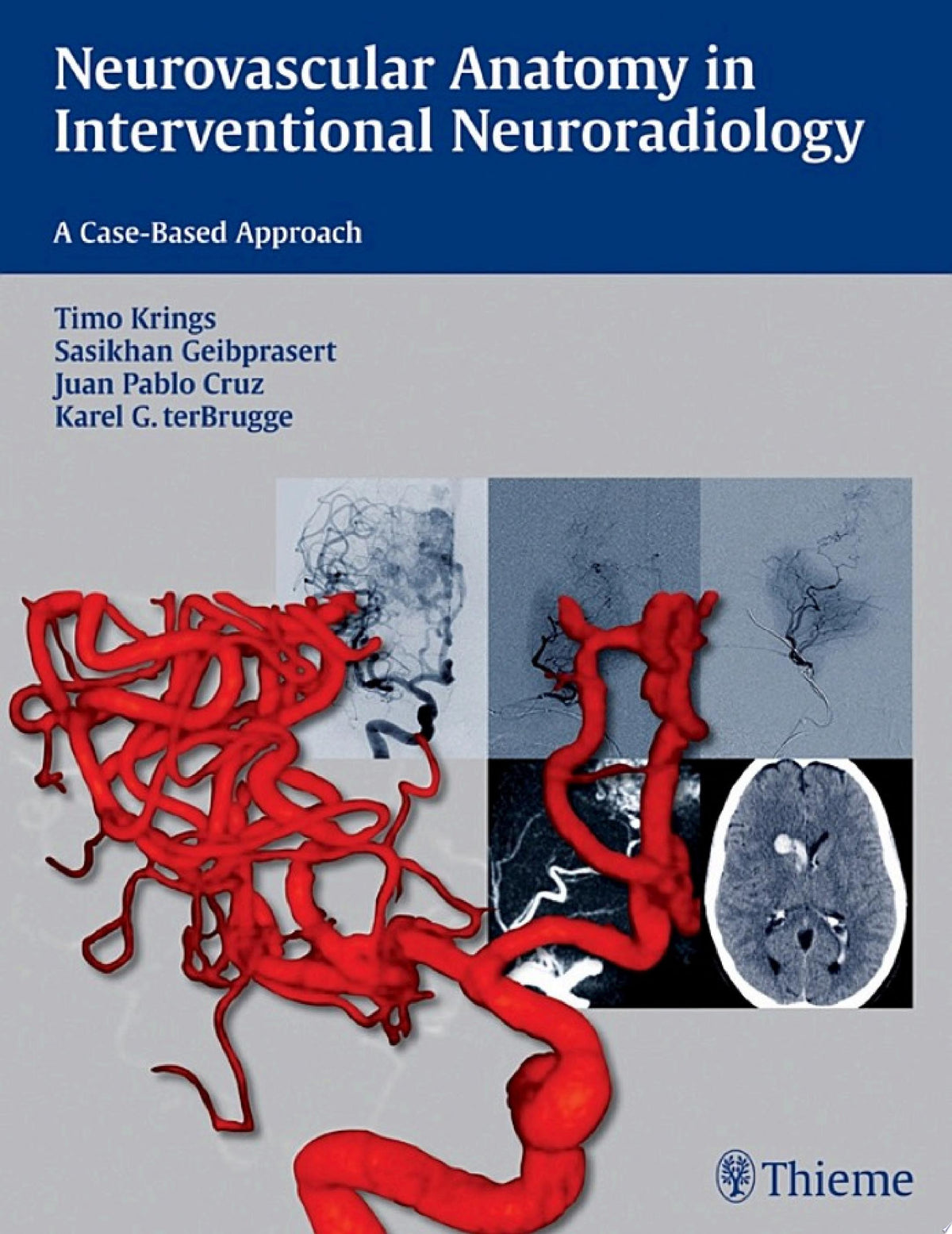 Neurovascular Anatomy in Interventional Neuroradiology: A Case-Based Approach