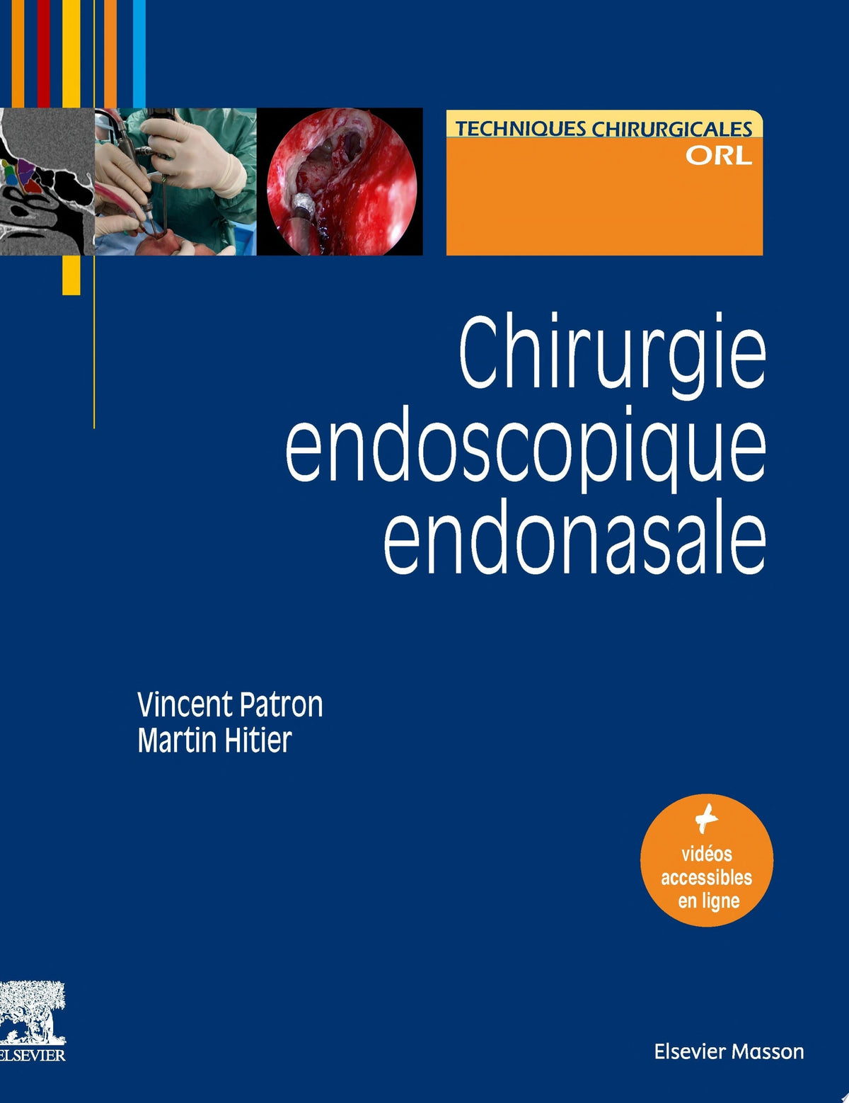 Chirurgie endoscopique endonasale