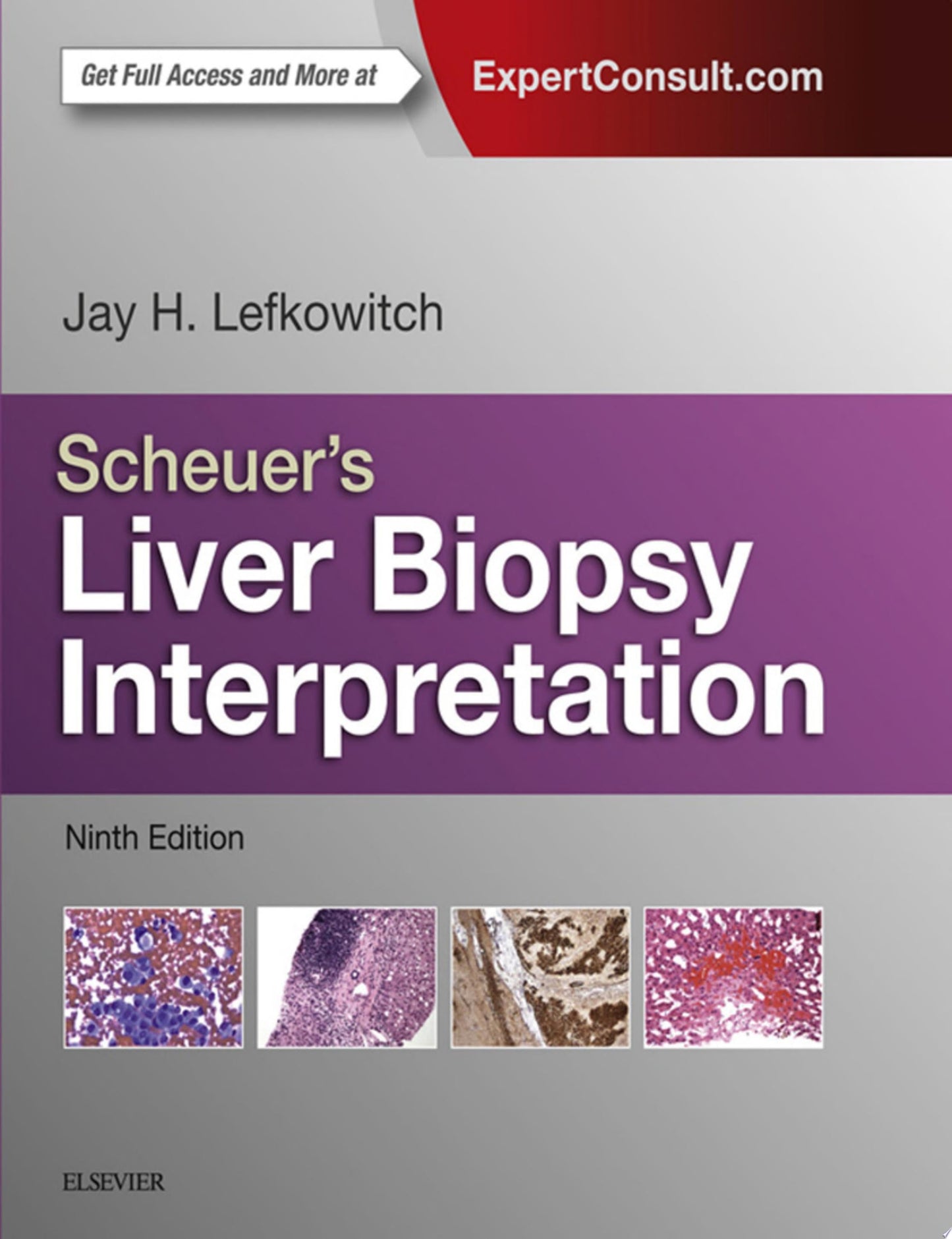 Biopsy Interpretation of the Liver, 2nd Edition