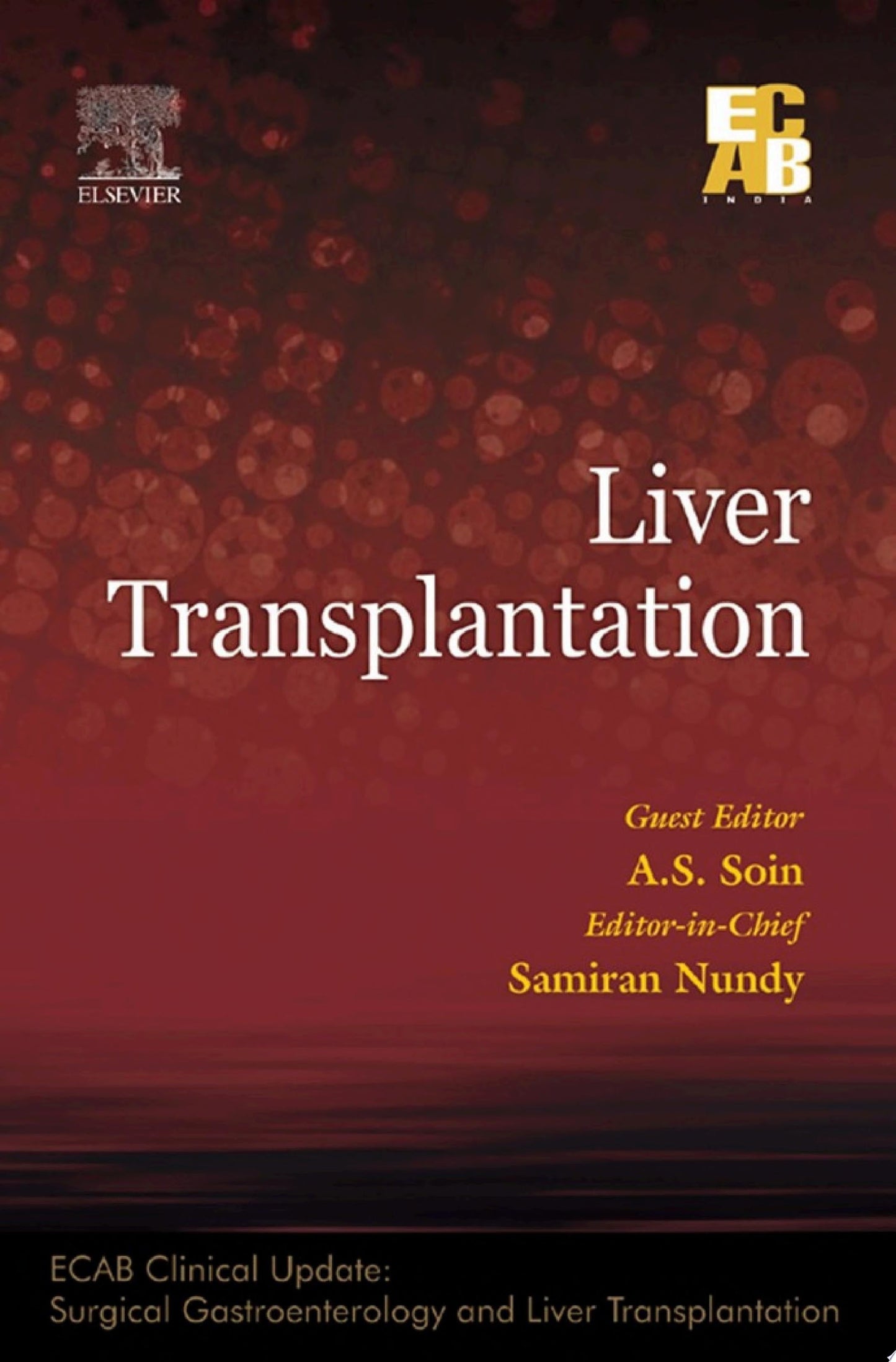 Liver Transplantation – ECAB