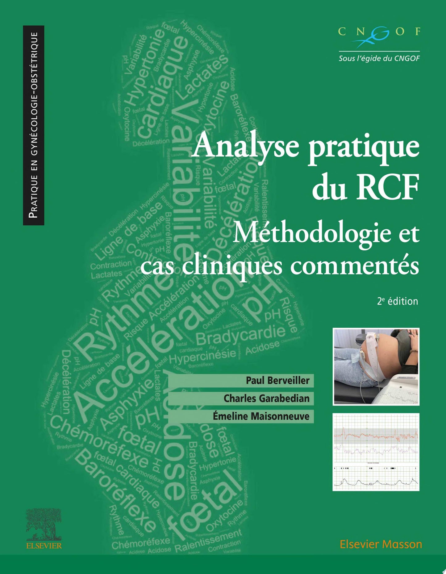 Analyse pratique du RCF : rythme cardiaque foetal: Méthodologie et cas cliniques commentés