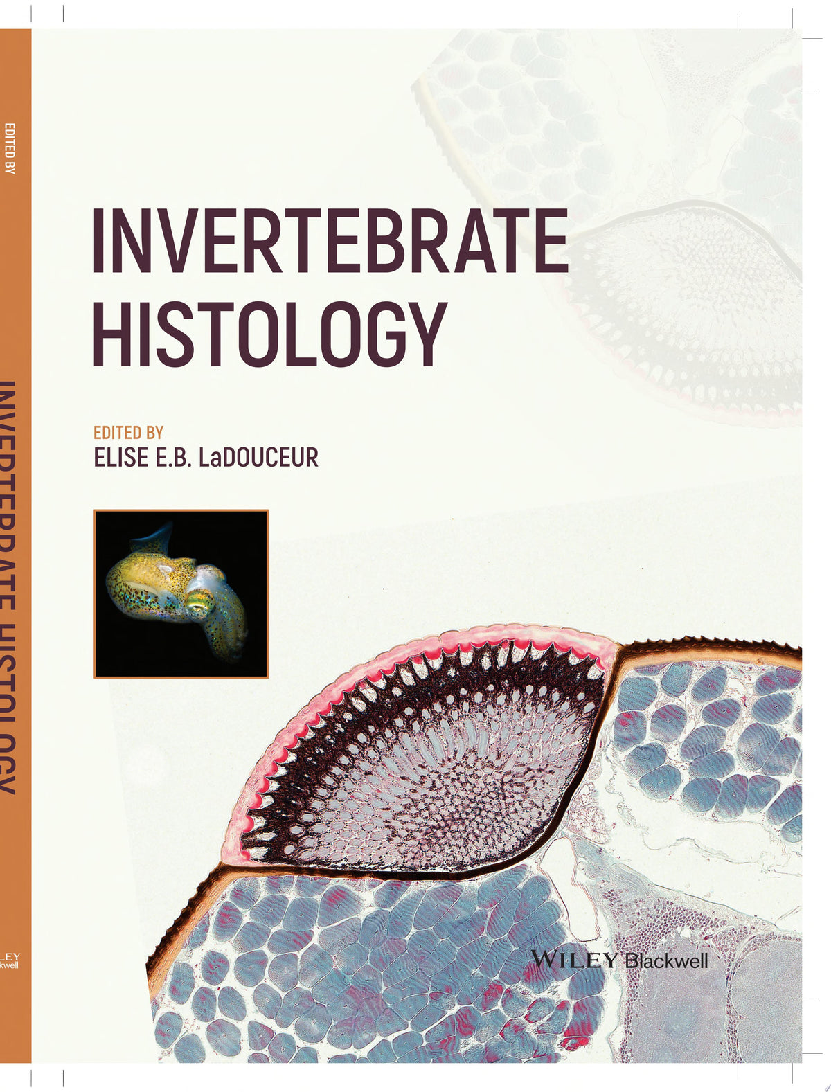 Microbiology: The Human Experience, 2nd Edition
