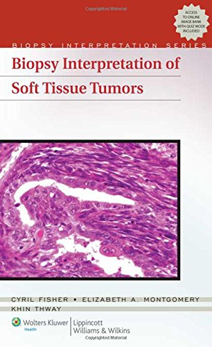 Biopsy Interpretation of Soft Tissue Tumors