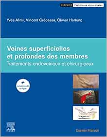 Veines superficielles et profondes des membres: Traitements endoveineux et chirurgicaux