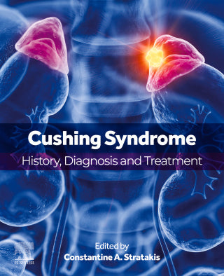 Cushing Syndrome