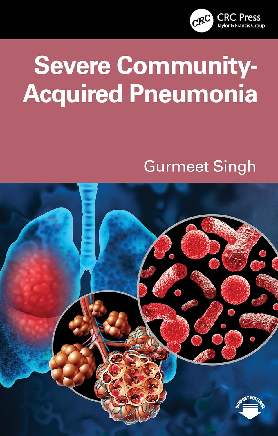 Severe Community-Acquired Pneumonia