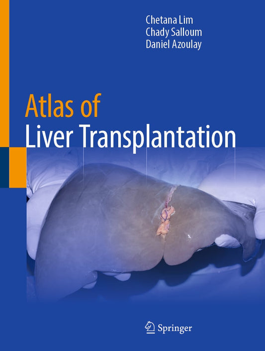 Atlas of Liver Transplantation