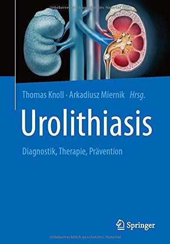 Urolithiasis: Diagnostik, Therapie, Prävention (German Edition)