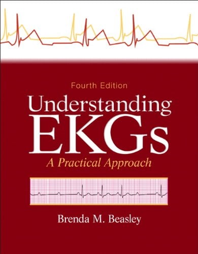 Understanding EKGs: A Practical Approach