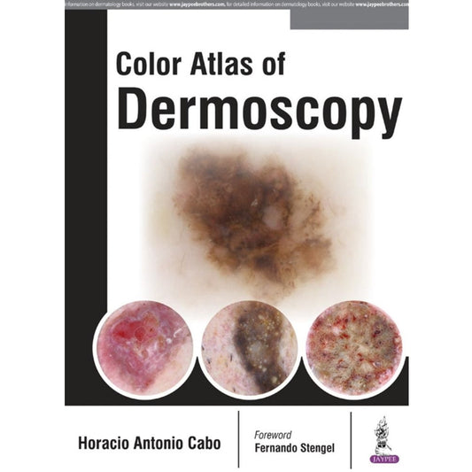 Color Atlas of Dermoscopy