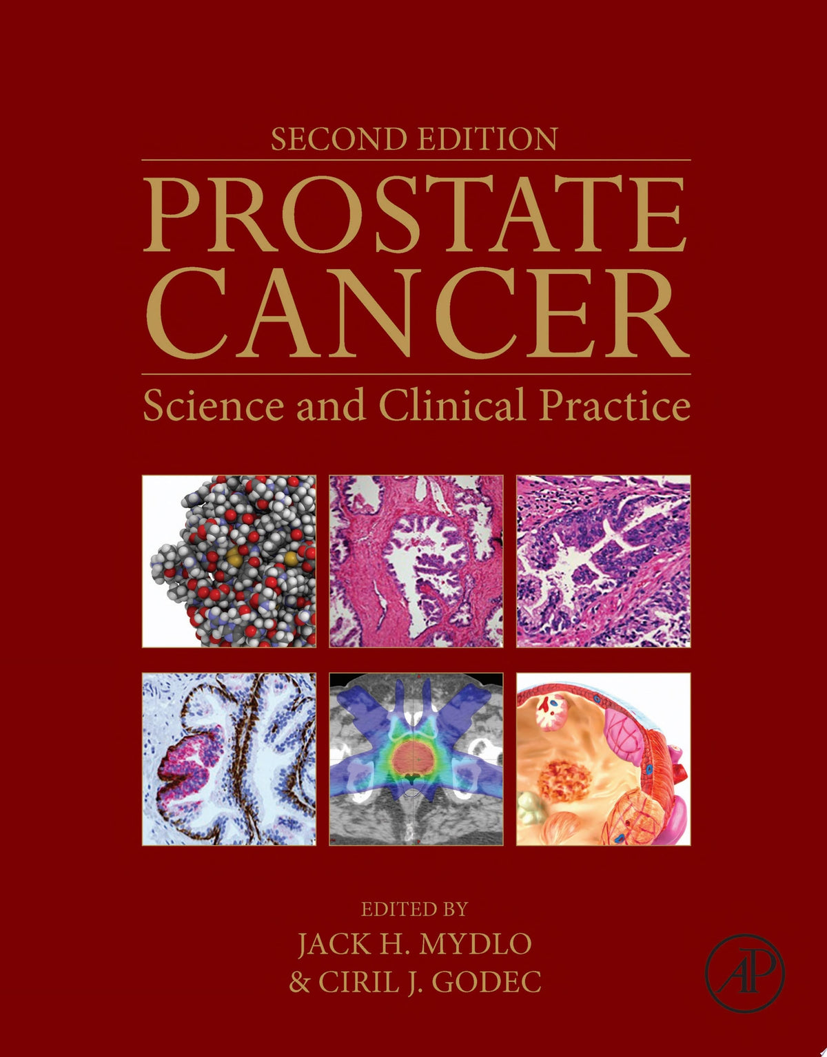 Prostate Cancer: Science and Clinical Practice, 2nd Edition
