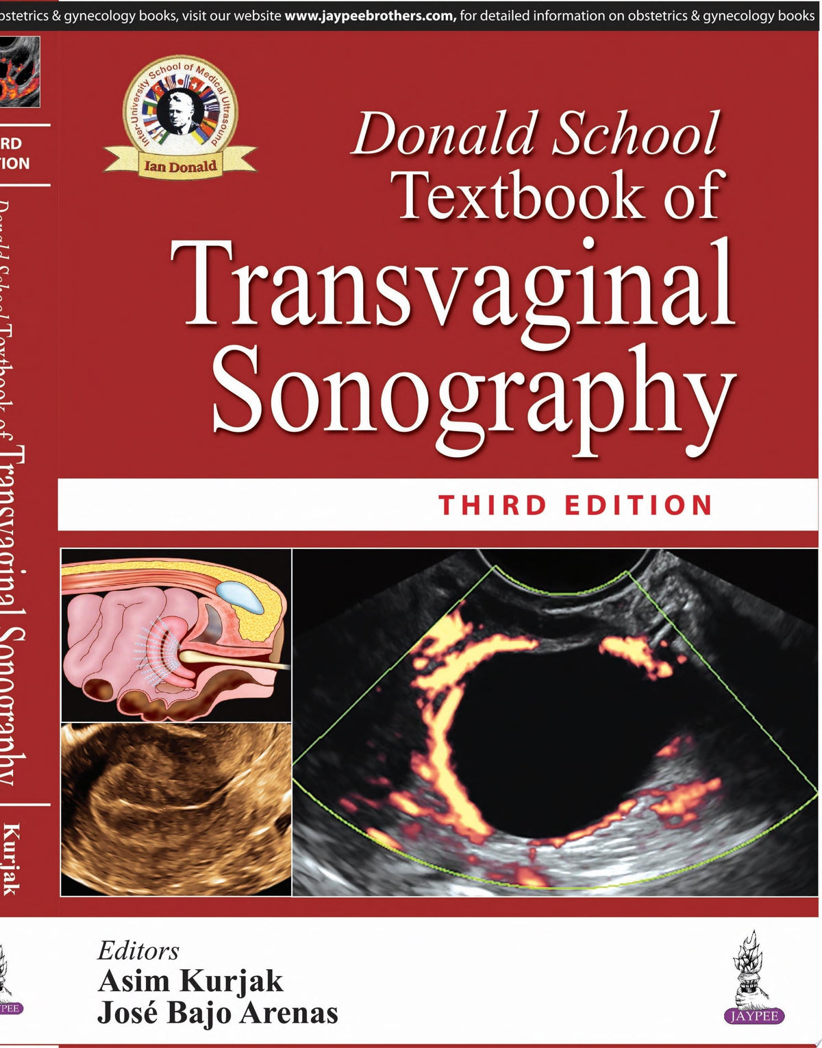 Donald School Textbook of Transvaginal Sonography, 3rd Edition