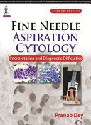 Fine Needle Aspiration Cytology: Interpretation and Diagnostic Difficulties, 2nd Edition