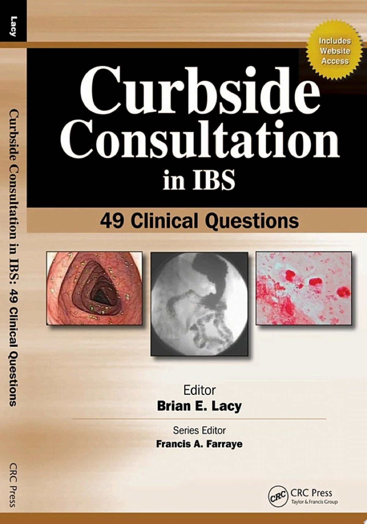 Curbside Consultation in IBS: 49 Clinical Questions