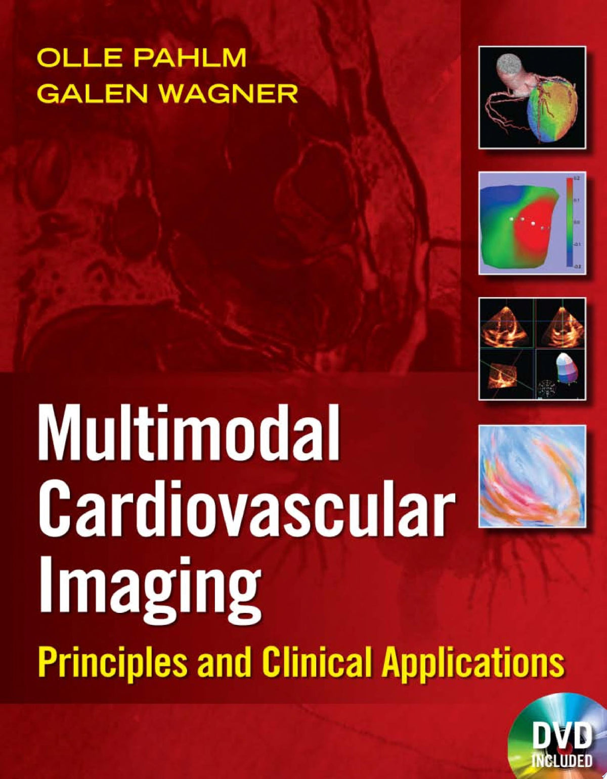 Multimodal Cardiovascular Imaging: Principles and Clinical Applications