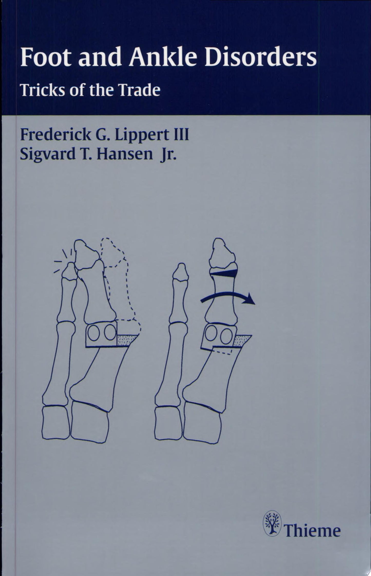 Foot and Ankle Disorders: Tricks of the Trade