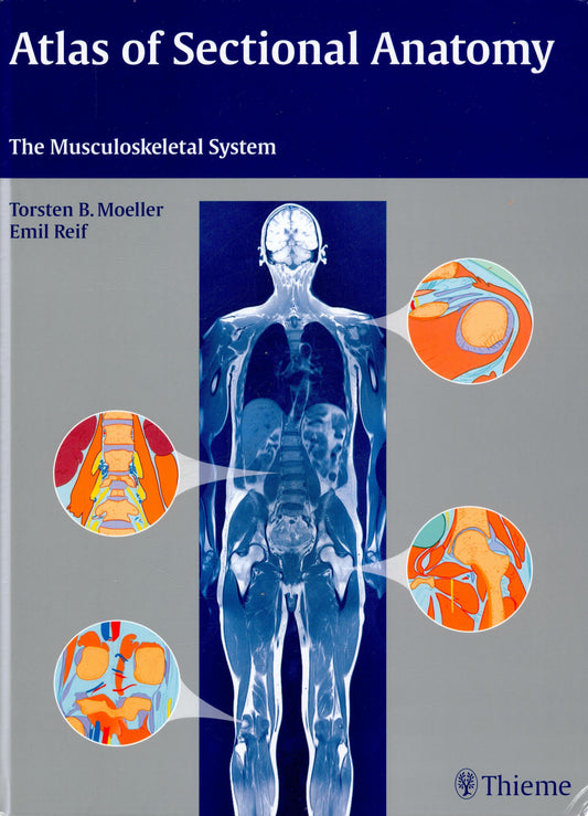 Atlas of Sectional Anatomy: The Musculoskeletal System