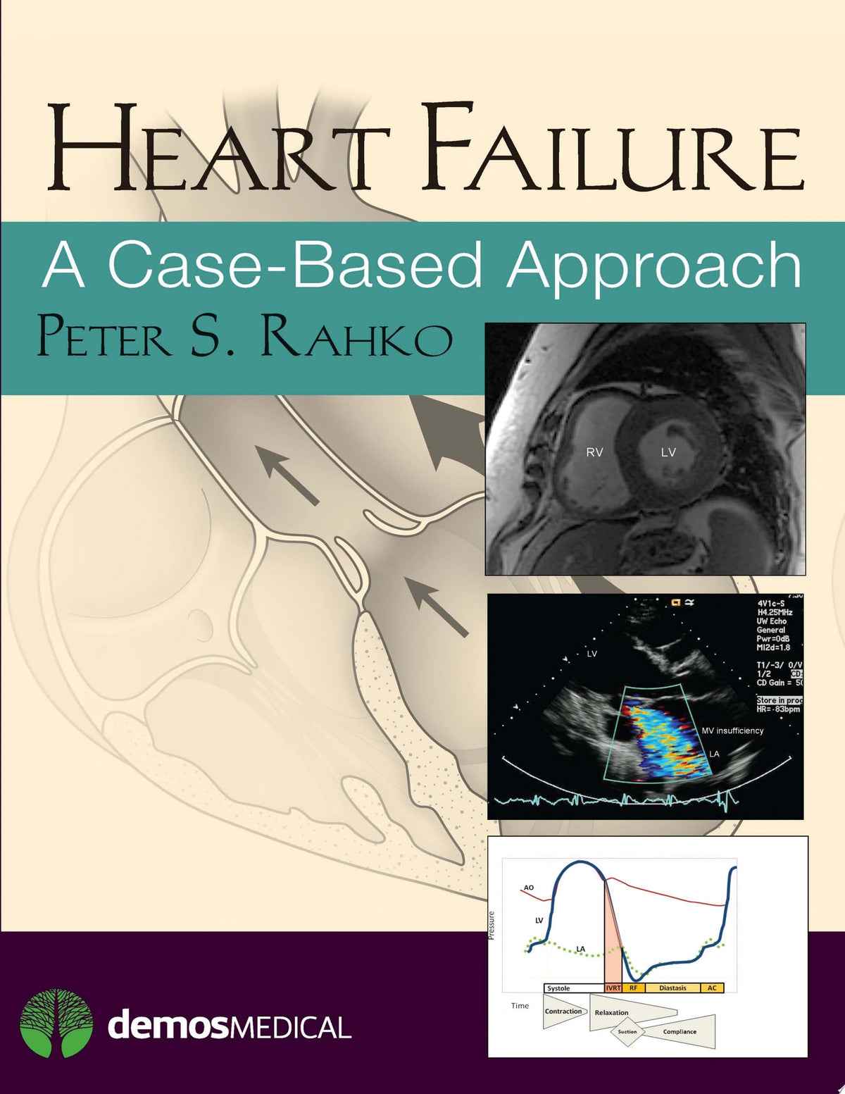 Heart Failure: A Case-Based Approach