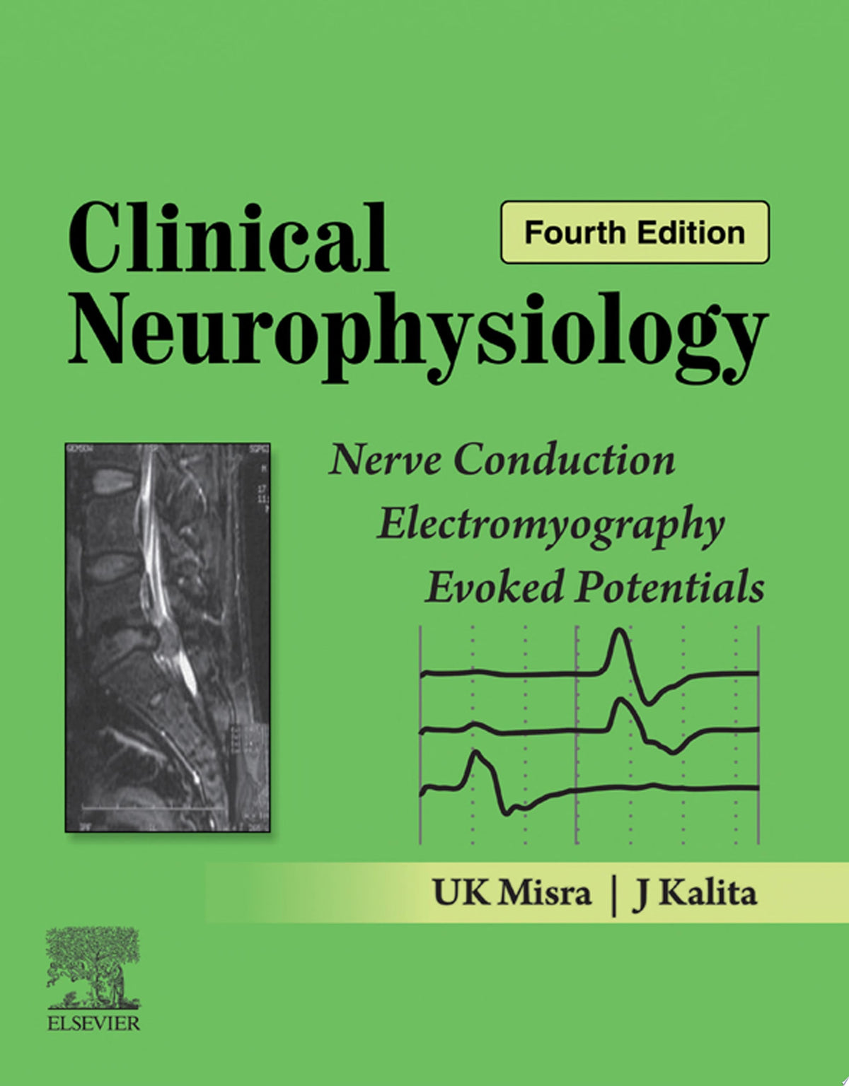 Clinical Neurophysiology: Nerve Conduction, Electromyography, Evoked Potentials, 4th Edition