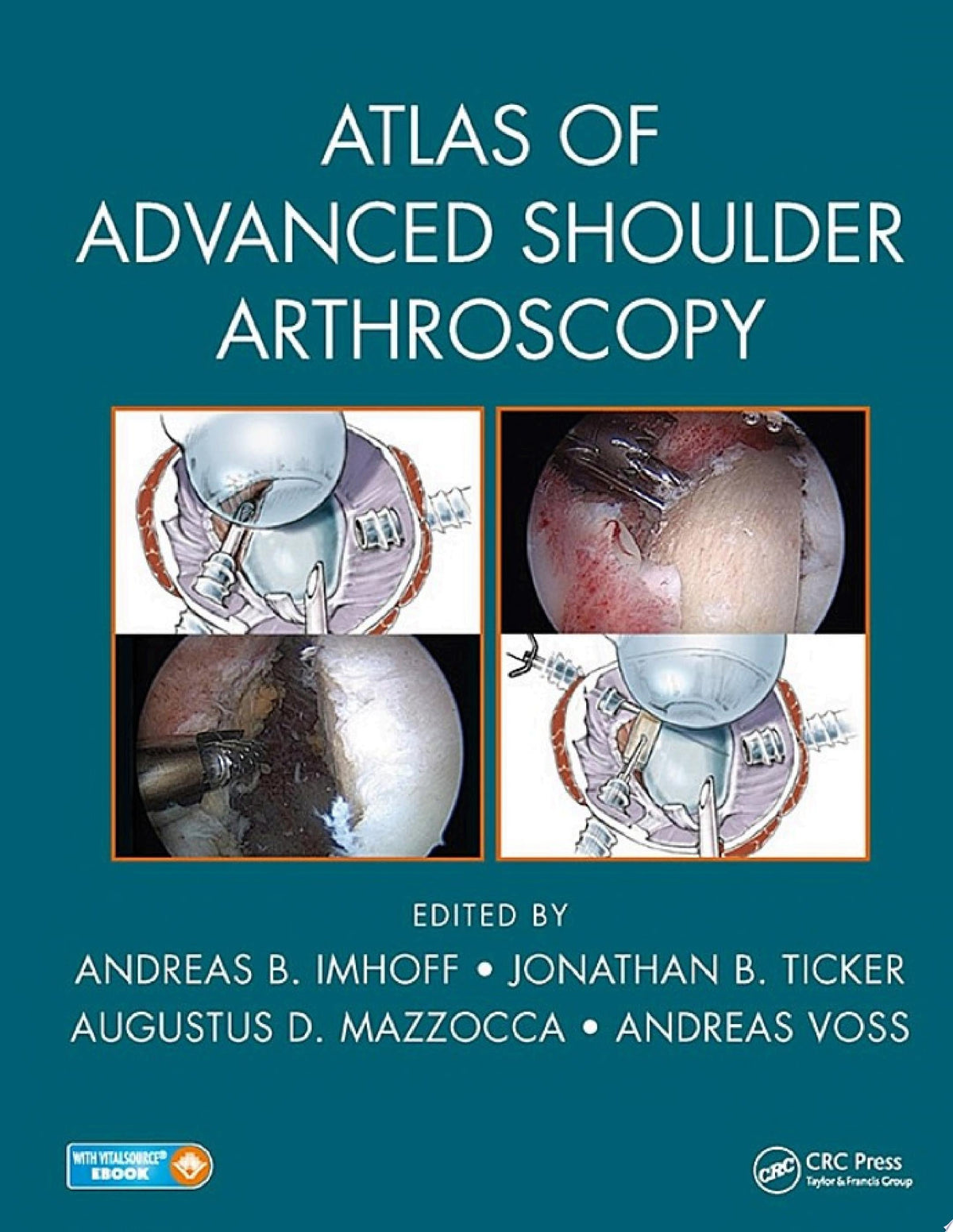 Atlas of Advanced Shoulder Arthroscopy