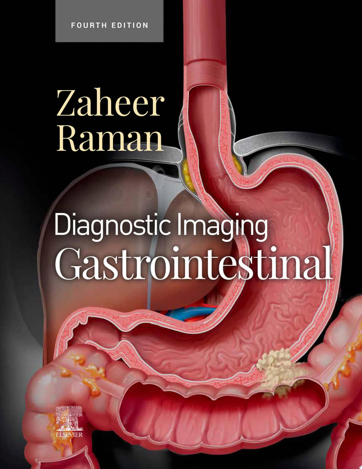 Diagnostic Imaging: Gastrointestinal, 4th Edition