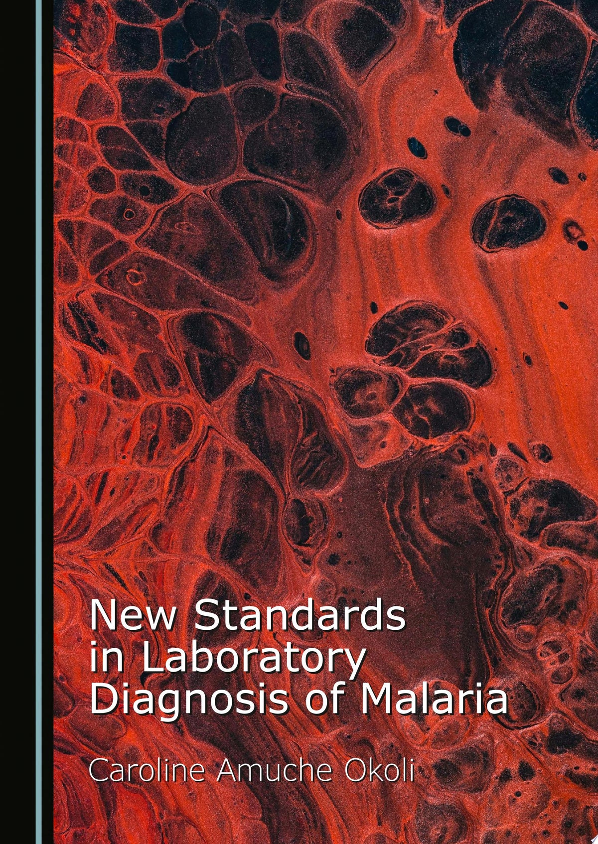New Standards in Laboratory Diagnosis of Malaria