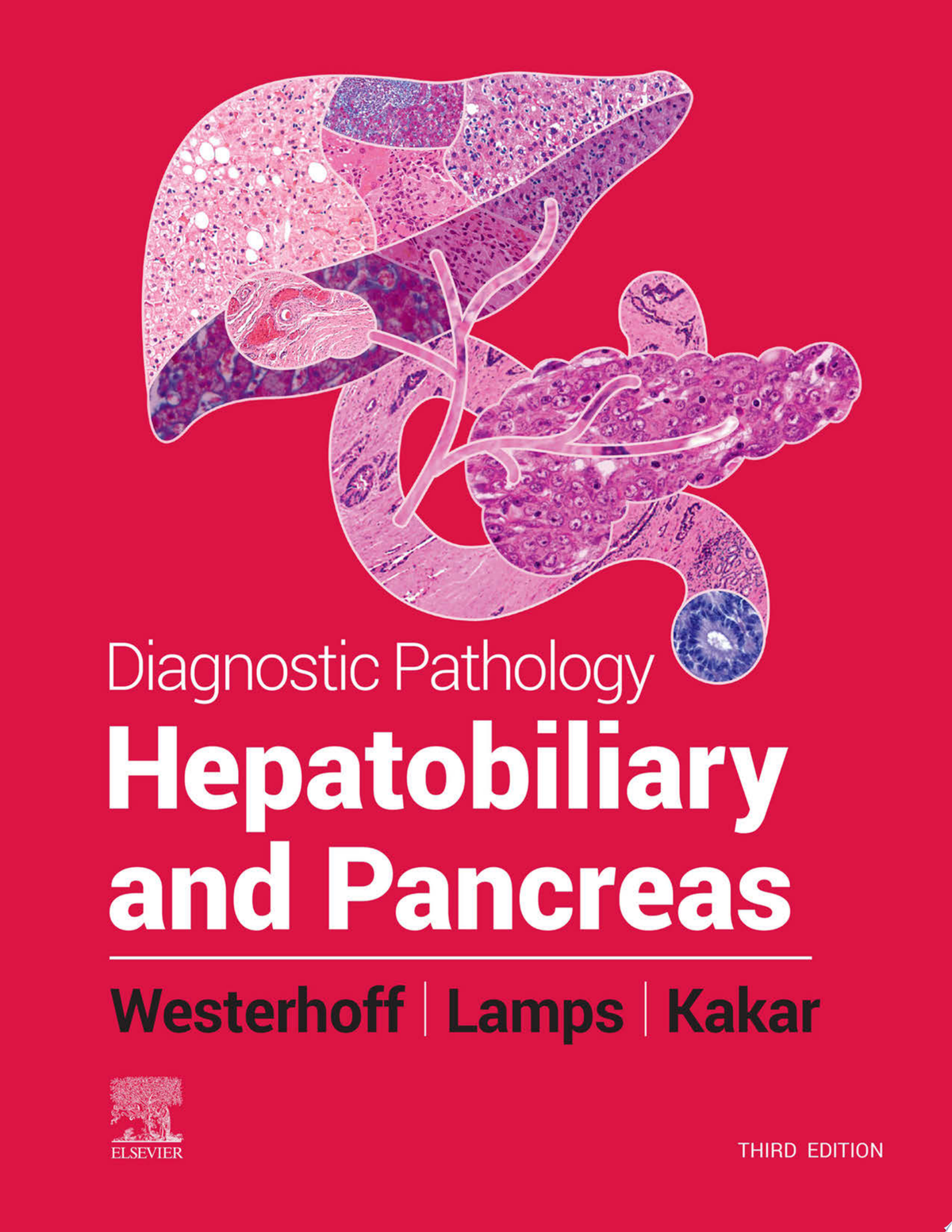 Diagnostic Pathology: Hepatobiliary and Pancreas, 3rd Edition