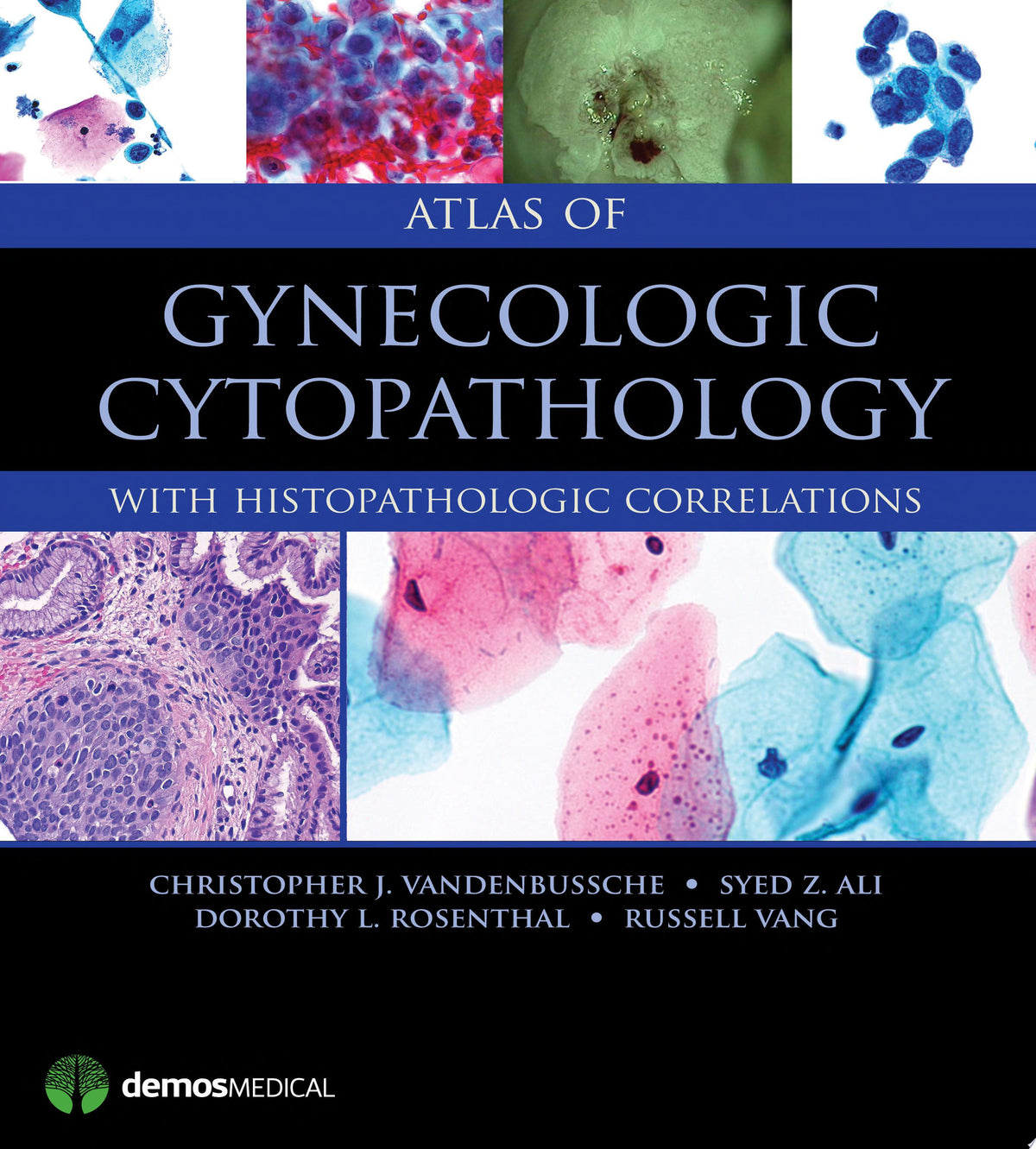 Atlas of Gynecologic Cytopathology with Histopathologic Correlations