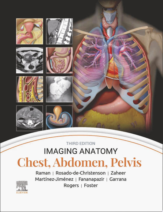 Imaging Anatomy: Chest, Abdomen, Pelvis, 2nd Edition