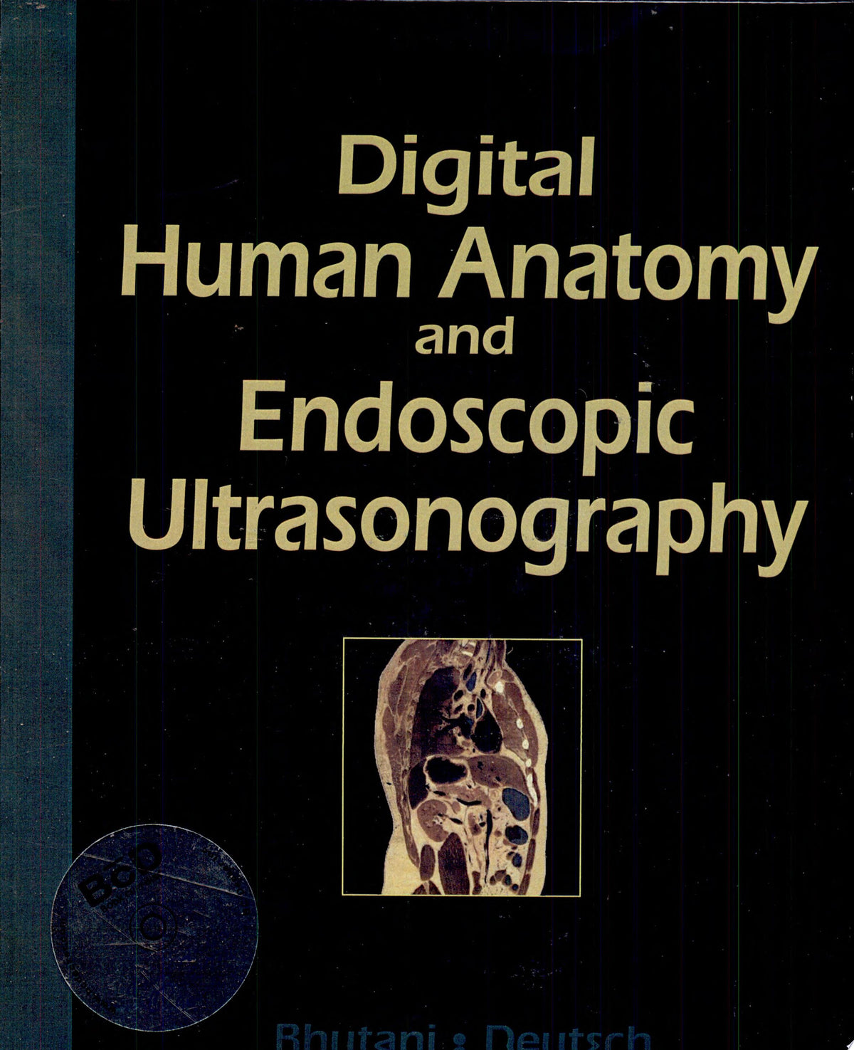 Digital Human Anatomy and Endoscopic Ultrasonography